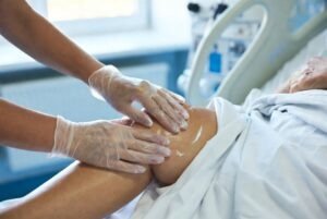 Medicinska sestra profesionalno nanosi vlažnu kremu na kožu noge kao dio preventivne njege kože i prevencije dekubitusa u specijaliziranom centru za rane.